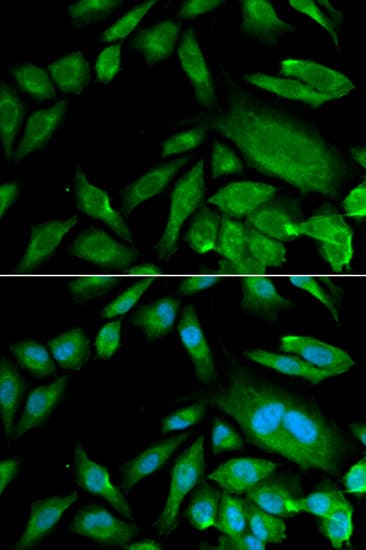 CDK6 Antibody