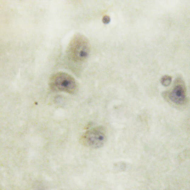 Polyclonal Rabbit anti-Human SRC Antibody (phospho-Ser75, IHC, IF, WB)