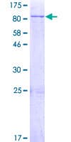 Human ERG1 / SQLE Protein (Recombinant GST)