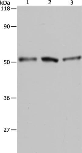 Polyclonal Rabbit anti-Human BAG5 Antibody (WB)