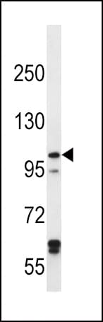 Polyclonal Rabbit anti-Human IREB2 / IRP2 Antibody (aa201-230, IHC, WB)