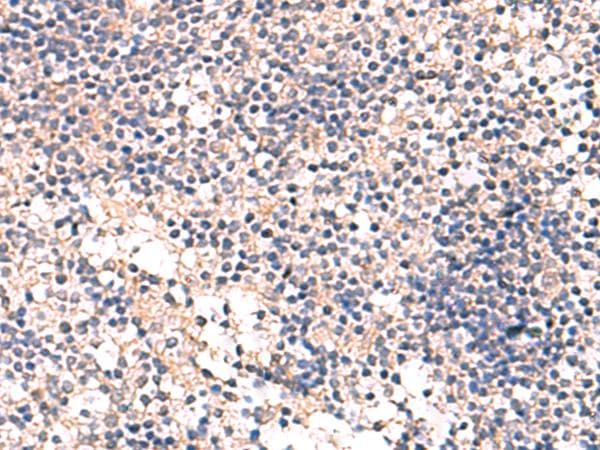 Polyclonal Rabbit anti-Human MKS1 Antibody (IHC)