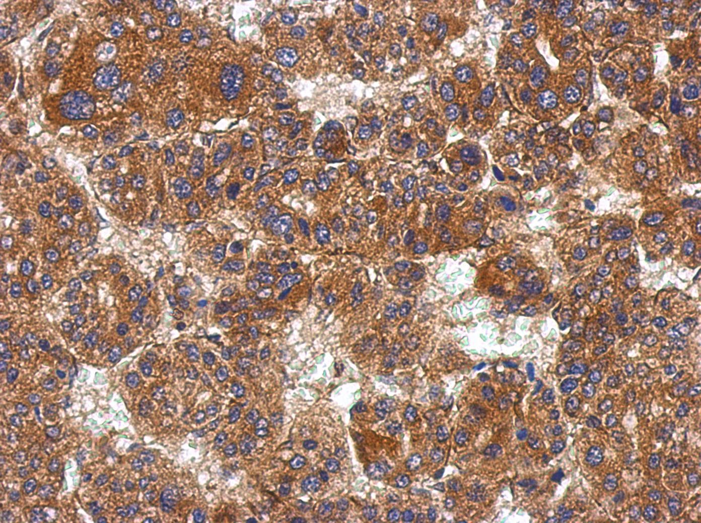 Polyclonal Rabbit anti-Human KCTD19 Antibody (IHC, WB)