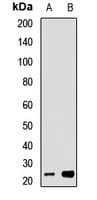 Polyclonal Rabbit anti-Human TIM23 Antibody (WB)