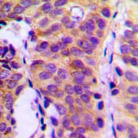 PLCG1 Antibody (Internal)