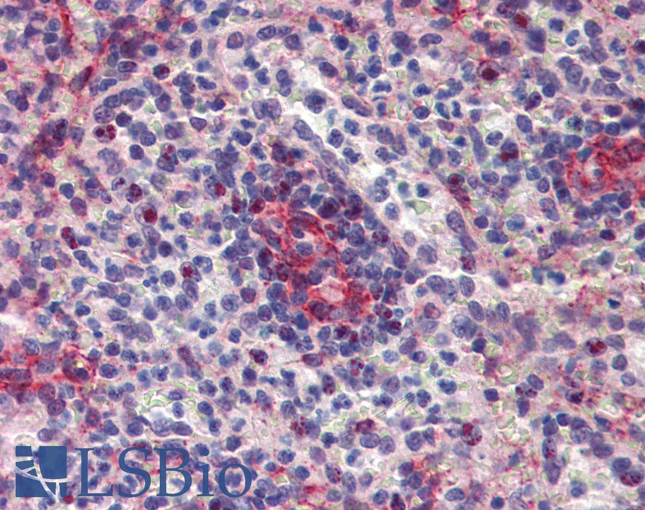 Polyclonal Rabbit anti-Human SEPT11 / Septin 11 Antibody (N-Terminus, IHC, WB)