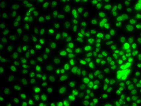 Polyclonal Rabbit anti-Human BTEB / KLF9 Antibody (IHC, IF, WB)