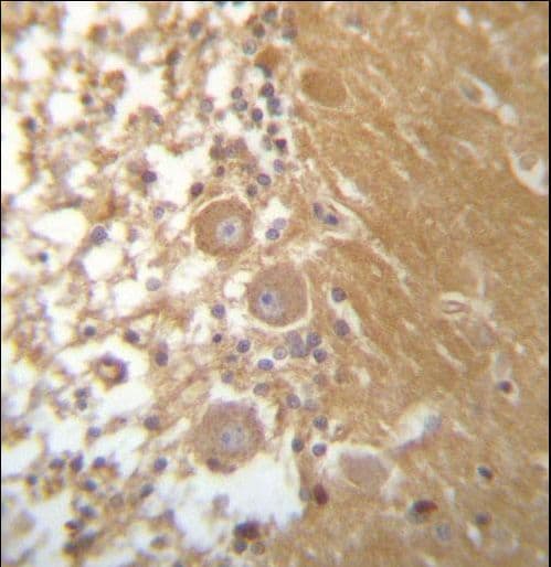 Polyclonal Rabbit anti-Human DEGS1 Antibody (aa1-30, IHC, WB)