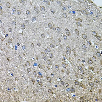 ANXA8L1 Antibody