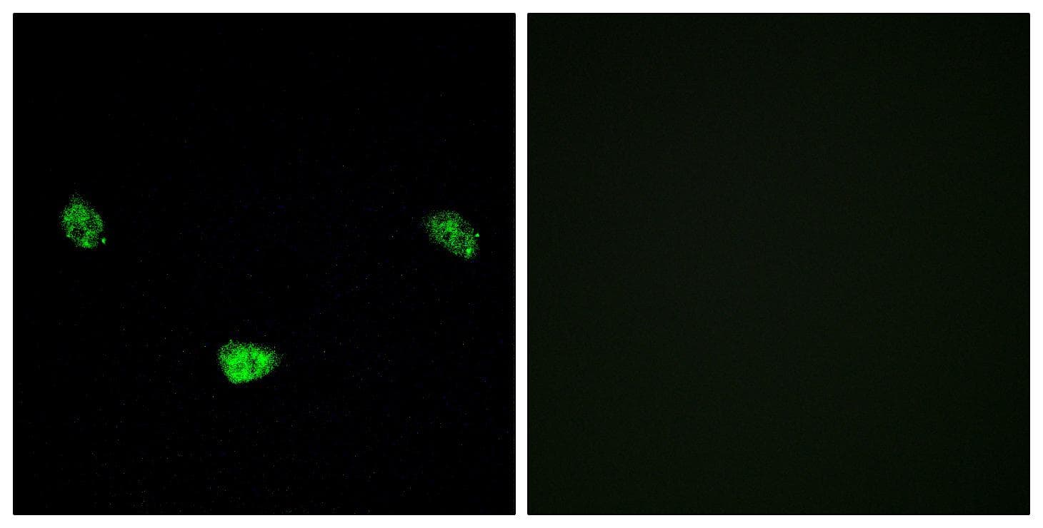 HNF4A / HNF4 Antibody (phospho-Ser313)