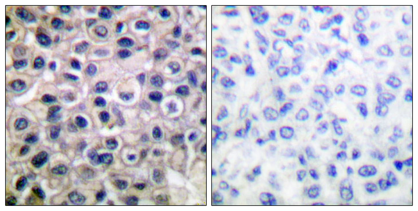 MMP14 Antibody (aa471-520)