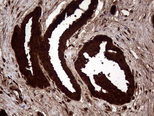 Monoclonal Mouse anti-Human AGR2 Antibody (clone OTI2B10, aa21-175, IHC, WB)