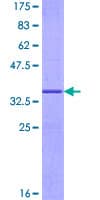Human G0S2 Protein (Recombinant GST)