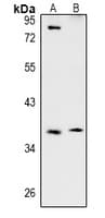 TSSK4 / TSSK5 Antibody