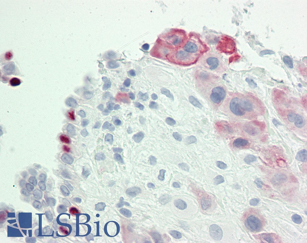 IHC-plus™ Polyclonal Rabbit anti-Human IGSF5 / JAM4 Antibody (aa1-30, IHC, WB)