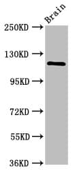 Polyclonal Rabbit anti-Human HIP1R Antibody (IHC, WB)