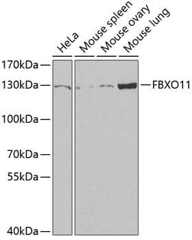 Polyclonal Rabbit anti-Human FBXO11 Antibody (IF, WB)