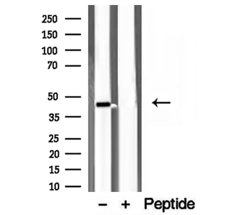 Polyclonal Rabbit anti-Human SCAD / ACADS Antibody (IHC, WB)