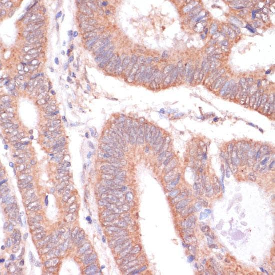KCNH2 / HERG Antibody