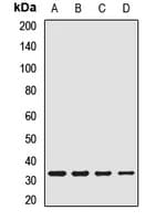 SLC25A1 / SEA Antibody