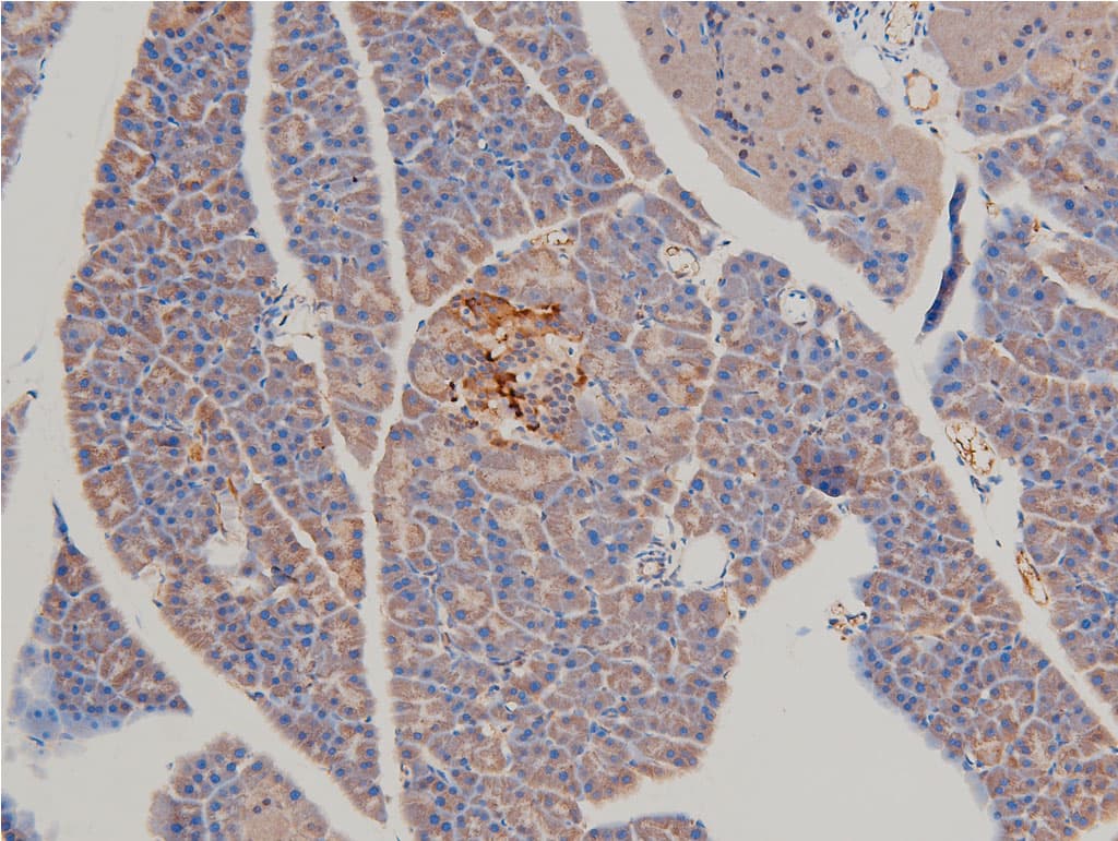 LIMK1 / LIMK Antibody (phospho-Thr508)