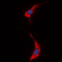 Polyclonal Rabbit anti-Human NRG1 / Heregulin / Neuregulin Antibody (N-Terminus, IF, WB)