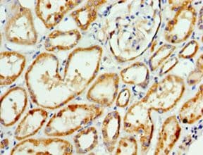 AP1M2 Antibody (aa164-423)