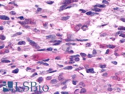 PathPlus™ GPR19 Antibody (Cytoplasmic Domain)