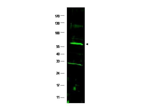 IHC-plus™ Polyclonal Rabbit anti-Human FANCC Antibody (IHC, WB)