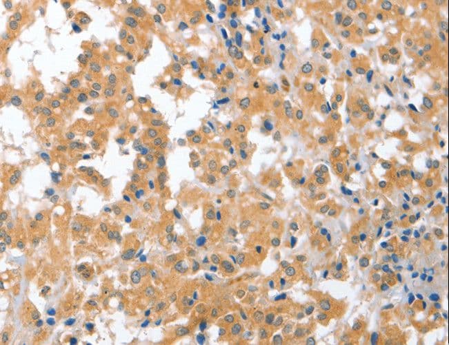 Yo / CDR2 Antibody