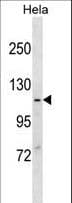 MVP / VAULT1 Antibody (aa12-39)