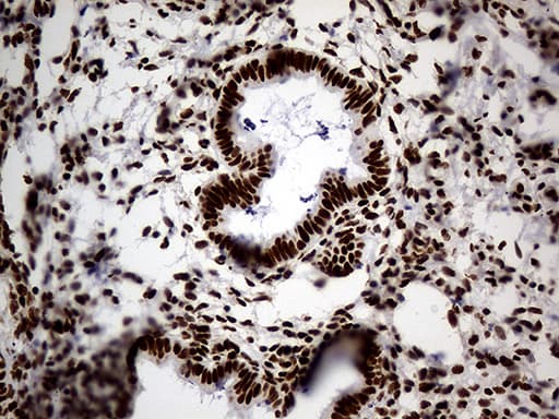 Monoclonal Mouse anti-Human HNRNPH1 / hnRNP H Antibody (clone OTI1H3, IHC, WB)