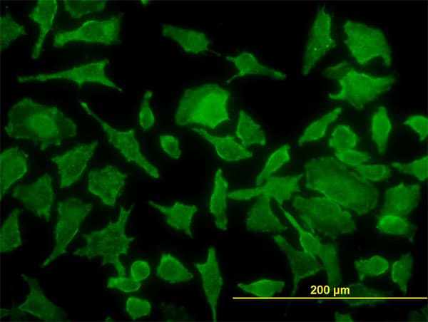 TPT1 / TCTP Antibody (clone 3C7)