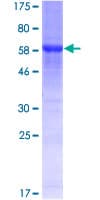 Human RRAGB / RAGB Protein (Recombinant GST)
