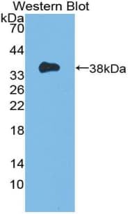 MCL1 / MCL 1 Antibody (aa6-328)