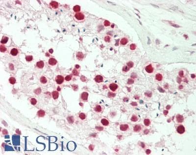 IHC-plus™ PHF6 Antibody (aa125-175)