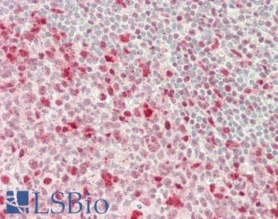 IHC-plus™ Polyclonal Rabbit anti-Human FKBP5 / FKBP51 Antibody (aa407-457, IHC, WB)