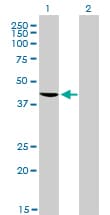 IHC-plus™ TDP-43 / TARDBP Antibody (clone 2E2-D3)