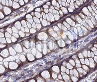 TGFA / TGF Alpha Antibody