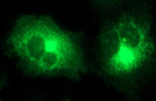 MMP13 Antibody (aa104-471, clone OTI1F1)