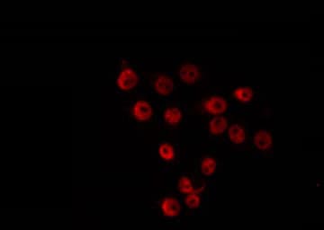 ZNF498 Antibody