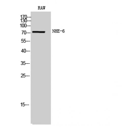 SLC9A6 Antibody (520-600 aa, Internal)