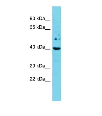 ESR2 / ER Beta Antibody (aa38-87)