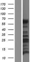 Human CALCR / Calcitonin Receptor Protein (Over-Expression Lysate Myc-DDK (Flag))