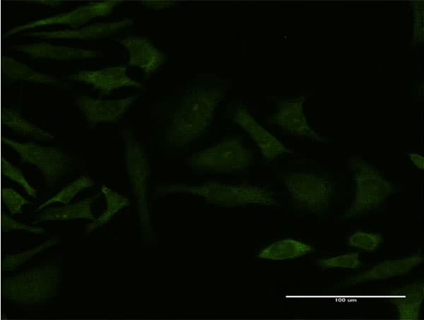 GRK4 Antibody (clone 6D12)