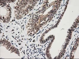 ERCC4 / XPF Antibody (clone OTI4E11)