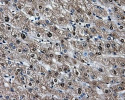 Heat Shock Protein 70 / HSPA1A Antibody (clone OTI2C12)