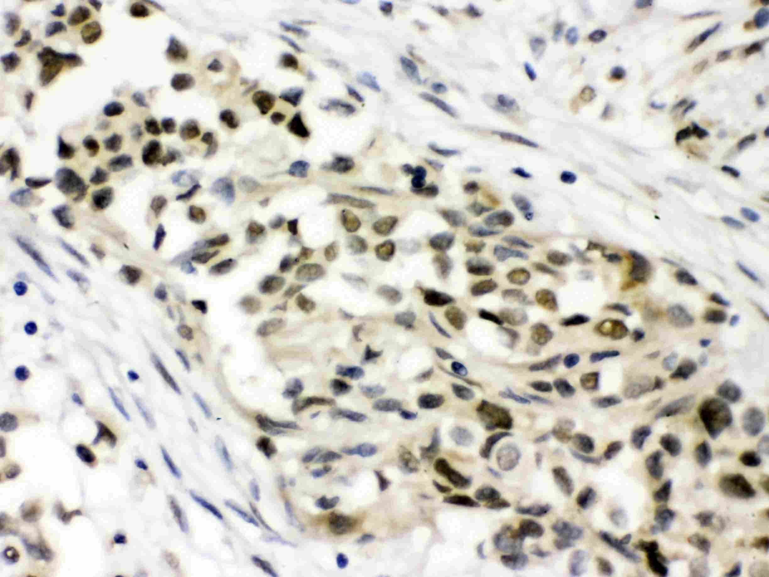 MAP3K8 / TPL2 Antibody
