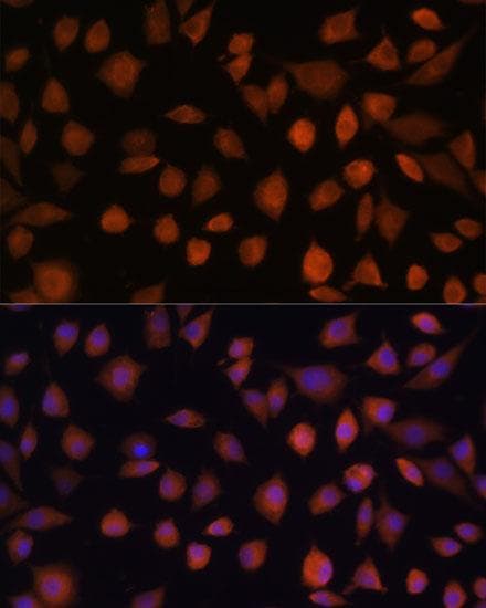 ARMC6 Antibody
