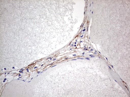 CNOT4 / CLONE243 Antibody (aa190-455, clone OTI1F10)
